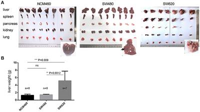 The Circular RNA Profiles of Colorectal Tumor Metastatic Cells